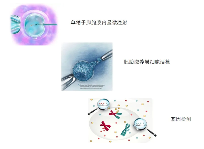 世界唐氏综合征日| 第三代试管婴儿技术，为健康宝宝保驾护航！