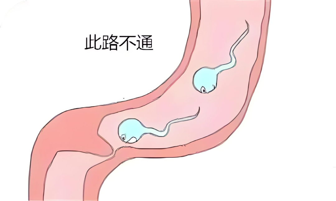 男性不育会影响怀孕吗？生不出娃，到底是谁的“锅”？男性不育的三大原因及治疗方案！
