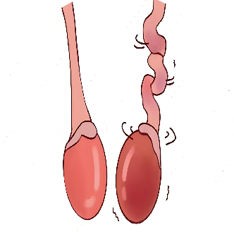男性不育会影响怀孕吗？生不出娃，到底是谁的“锅”？男性不育的三大原因及治疗方案！