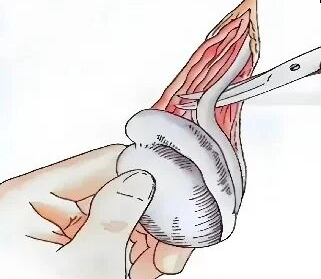 男性不育会影响怀孕吗？生不出娃，到底是谁的“锅”？男性不育的三大原因及治疗方案！