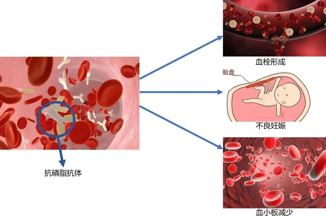 胚胎停止发育的原因有哪些？卵子质量如何影响囊胚形成率？如何提高囊胚培养成功率？