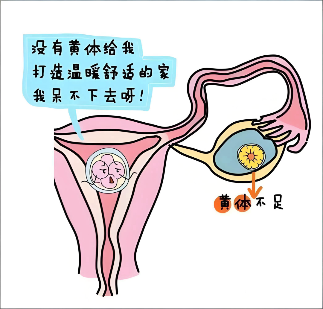黄体支持有哪些方式?试管婴儿移植后为什么必须进行黄体支持? 黄体支持有哪些方式?试管婴儿移植后为什么必须进行黄体支持?