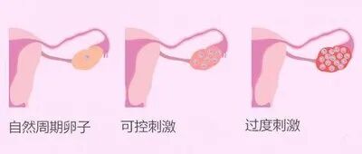 试管婴儿促排期间需要补充蛋白质吗?促排期间如何科学补充蛋白质? 试管婴儿促排期间需要补充蛋白质吗?促排期间如何科学补充蛋白质?