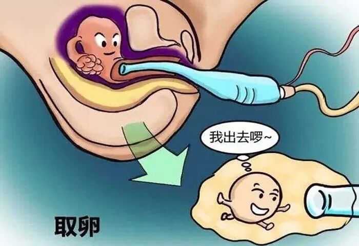 试管婴儿促排药物怎么选?如何改善卵泡营养提高卵子质量? 试管婴儿促排药物怎么选?如何改善卵泡营养提高卵子质量?