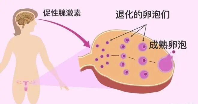 试管婴儿促排药物怎么选?试管婴儿备孕选促排药纠结国产还是进口? 试管婴儿促排药物怎么选?试管婴儿备孕选促排药纠结国产还是进口?