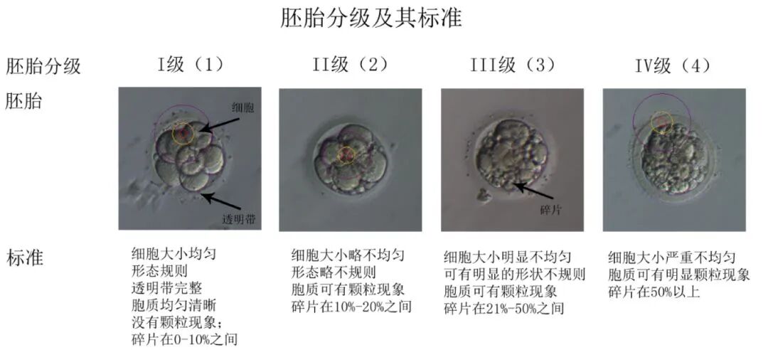 试管婴儿移植了高评分胚胎就一定能备孕成功吗?胚胎形态学评分到底看的是什么? 试管婴儿移植了高评分胚胎就一定能备孕成功吗?胚胎形态学评分到底看的是什么?