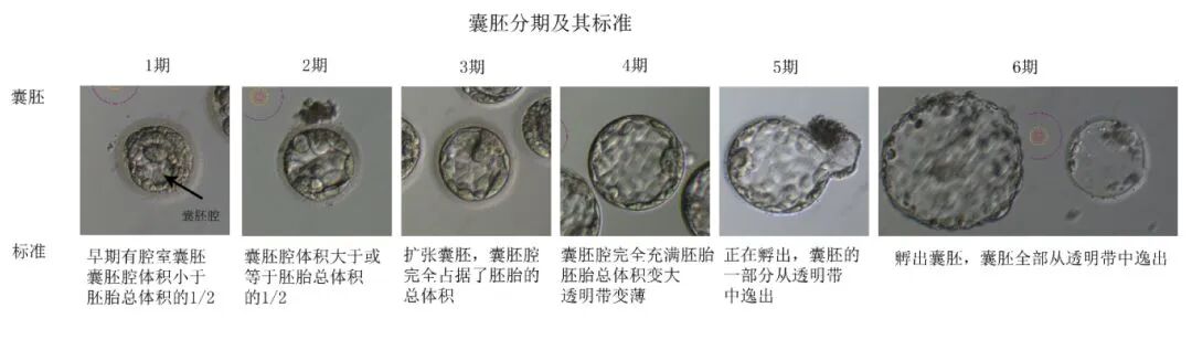 试管婴儿移植了高评分胚胎就一定能备孕成功吗?胚胎形态学评分到底看的是什么? 试管婴儿移植了高评分胚胎就一定能备孕成功吗?胚胎形态学评分到底看的是什么?