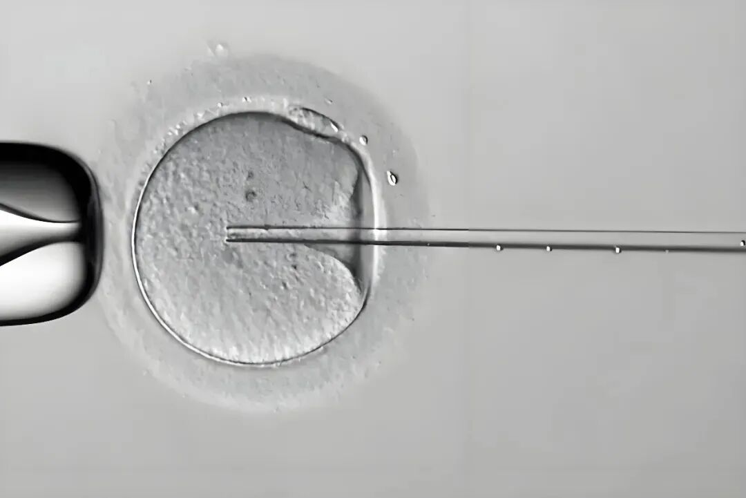 试管婴儿成功率更高?人工授精和试管到底有什么区别? 试管婴儿成功率更高?人工授精和试管到底有什么区别?