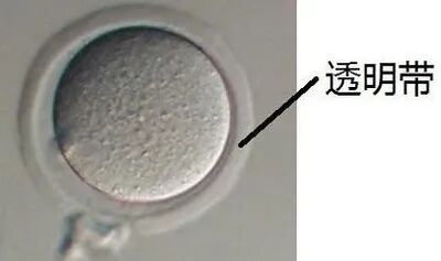 试管婴儿成功率更高?人工授精和试管到底有什么区别? 试管婴儿成功率更高?人工授精和试管到底有什么区别?