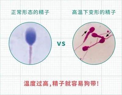 试管婴儿屡次失败?准爸爸的精子质量达标了吗? 试管婴儿屡次失败?准爸爸的精子质量达标了吗?