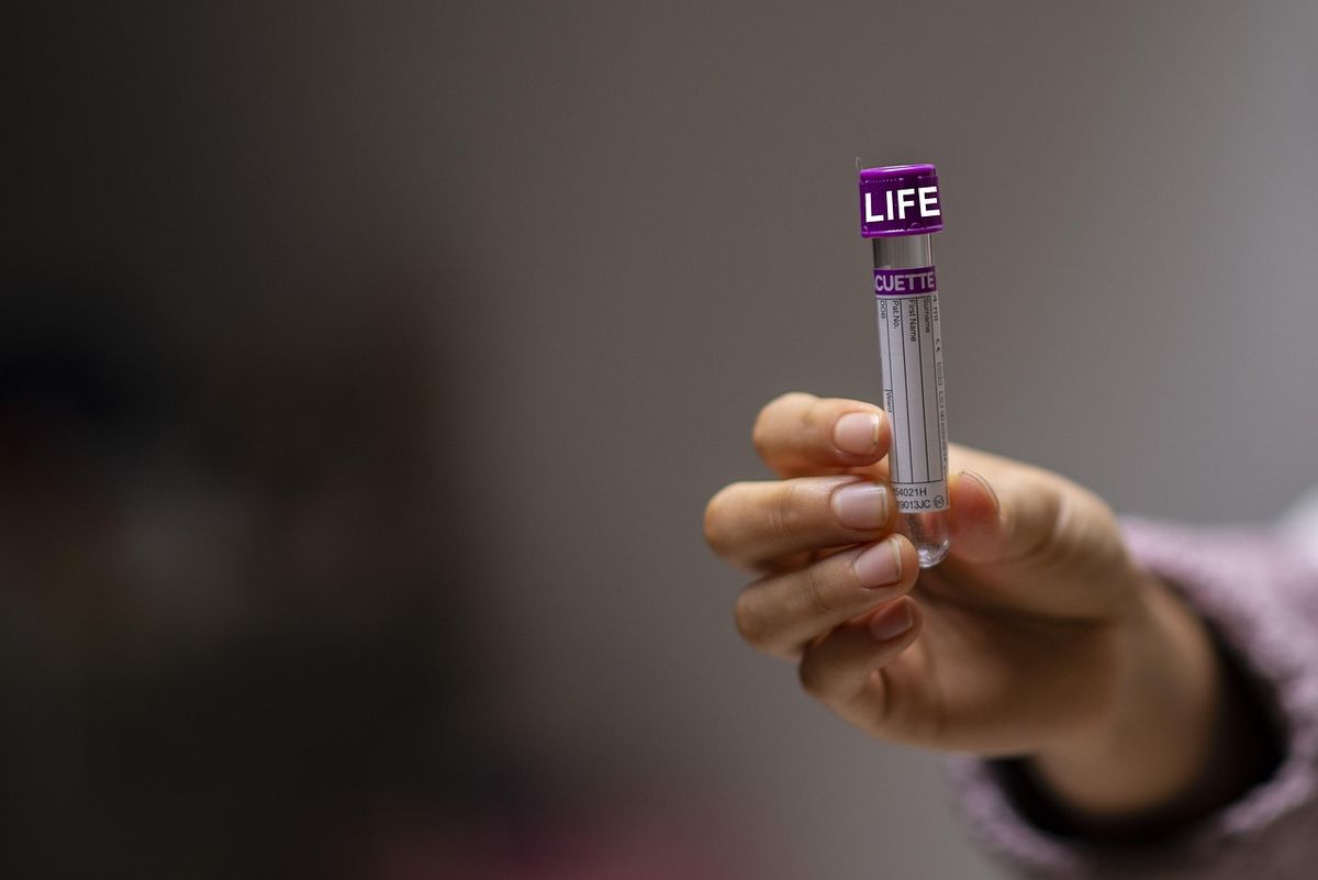试管婴儿二代(ICSI)费用怎么算?这笔开支由什么决定 试管婴儿二代(ICSI)费用怎么算?这笔开支由什么决定